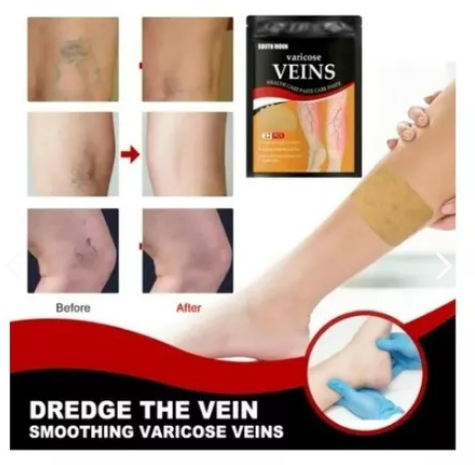 Combo Vil VarysBiotic x3 + Parche